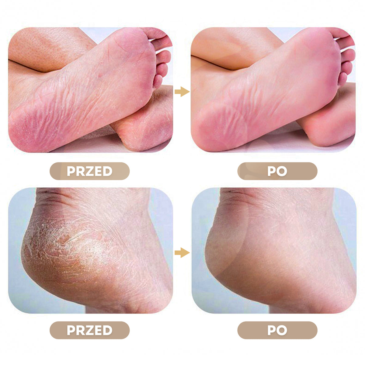 Pumeks Kryształowy do Stóp z Nano Szkła Tarka do Pięt Pilnik 3D Złoty