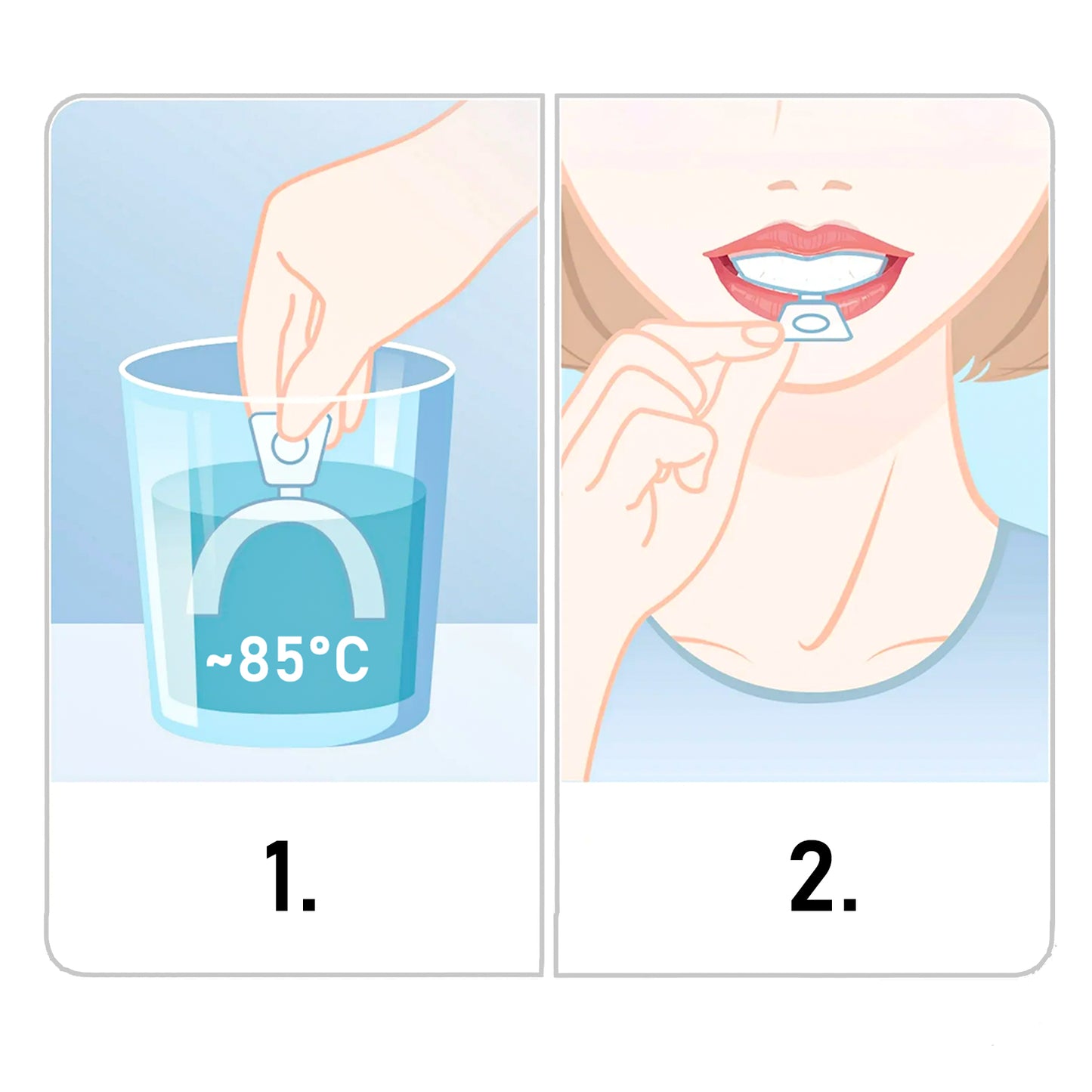 Entspannungsschiene gegen Zähneknirschen (Bruxismus) zum Schutz des Zahnschmelzes